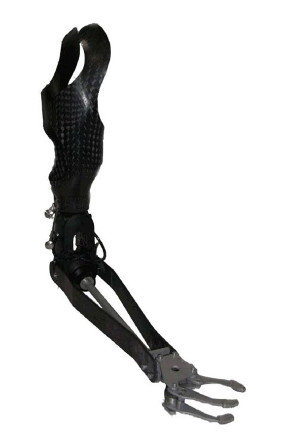 robotic arm prosthesis